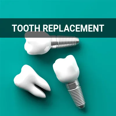 Visit our Tooth Replacement page